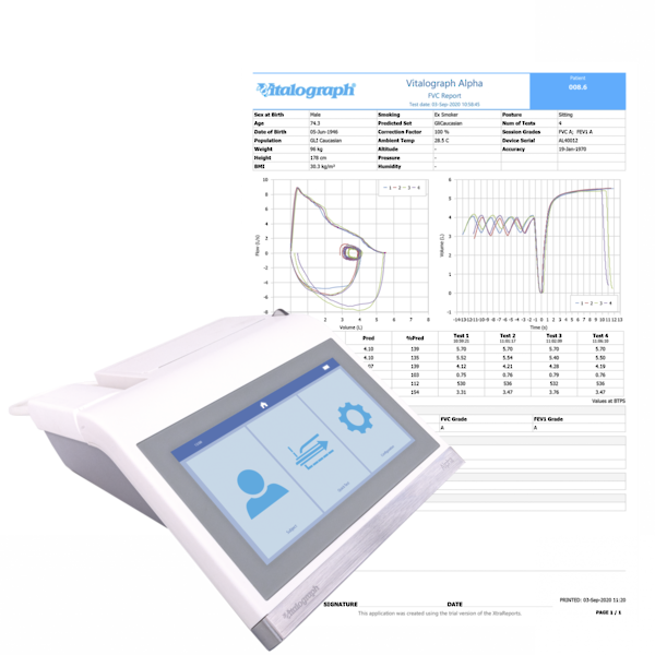Vitalograph ALPHA, Print to integrated thermal printer or to PC using device studio PDF software included - Desktop Spirometer image 1
