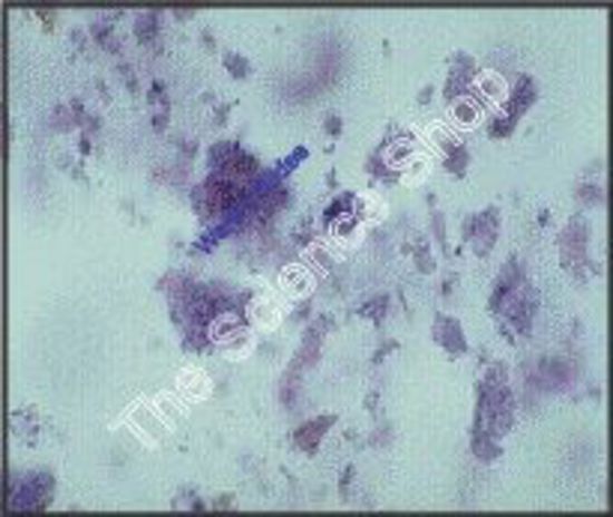 Human blood smear, wright's stain