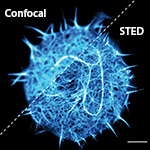 LEIM Tcell-stellaris Confocal V STED