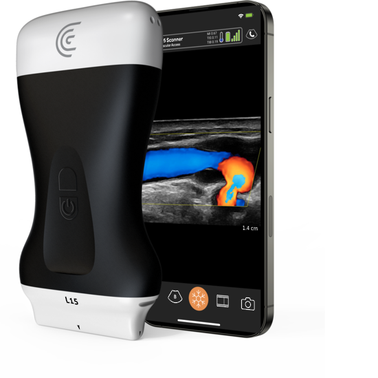 Clarius Handheld Ultrasound L15 HD3 High-Frequency Linear Scanner with 3 Year Membership
