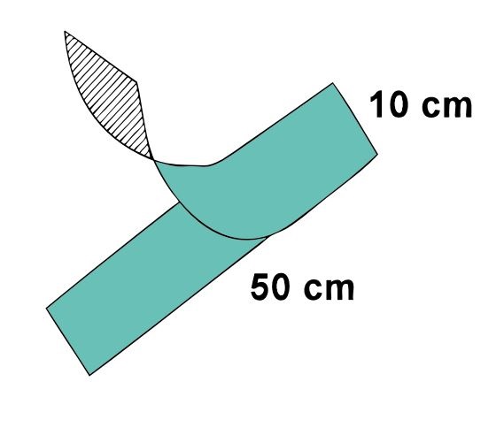 Sengewald Drape Tape Sterile Adhesive 10 x 50cm