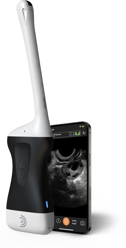 Clarius Handheld Ultrasound EC7 HD3 Endocavity Scanner with 3 Year Membership image 0
