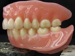 Side view full set of dentures