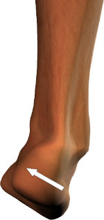 Supination of the feet