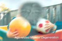Eye_disease_age-related_macular_degeneration.jpg