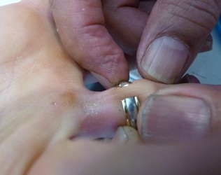ring cut off by Auckland jeweller