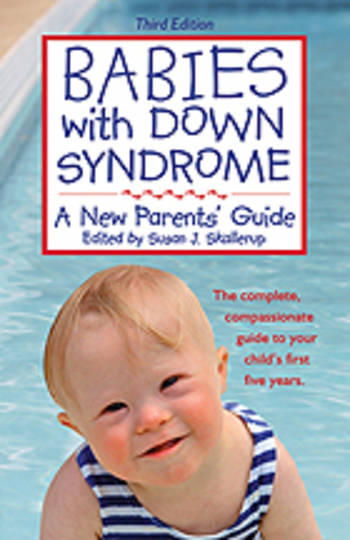 Babies with Down Syndrome A New Parents' Guide, Third Edition