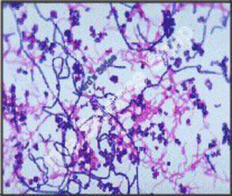 Typical Mixed Bacteria (sm) Coccus bacillus and spirillium; type forms G positive and Gve