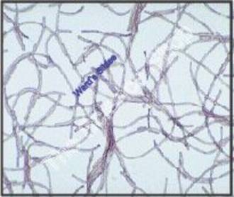 Bacterial Cell Wall (sm) D