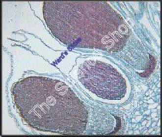 Marchantia Mature Sporophyte (ls)