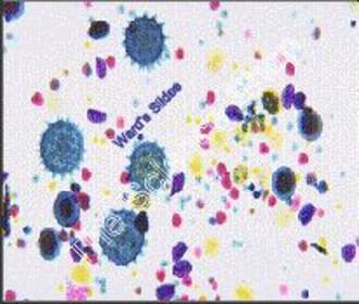 Mixed Pollen (wm) Stained pollen supplied with key card QS