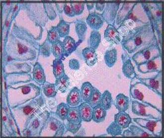 Lilium Anther Late Prophase (cs) QS