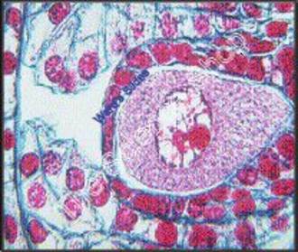 Lilium Ovary Megaspore Mother Cell (cs) QS