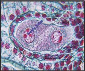 Lilium Ovary Binucleate Embryo Sac (cs) QS