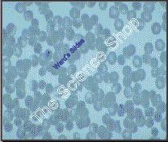 Plasmodium vivax Stages (wm) Thin blood smear showing typical forms