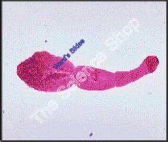 Echinococcus granulosus (wm) Minute tapeworm of carnivores