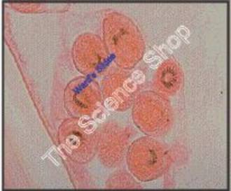 Echinococcus granulosus Hydatid Cyst sect Relationship of brood capsule scolices and cyst wall