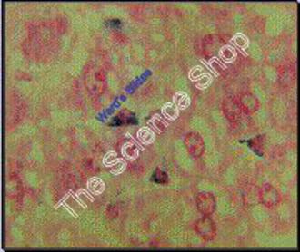 Phagocytsis (sect) Liver macrophaqes engulfing a vital dye