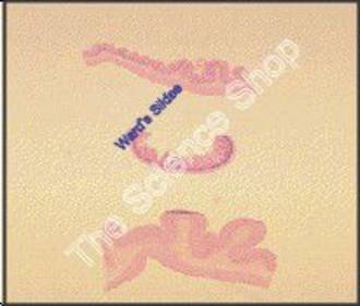 Digestive System 3 Regions (cs) mammal Stomach small intestine and large intestine H and E