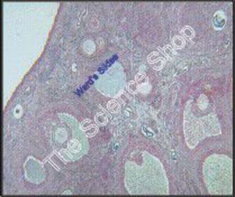 Ovary Graafian Follicle cat (sect) Mature follicles with germ hill and large ovum H and E