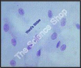 Barr Bodies (sm) CV Cheek cells of normal human male and female Shows absence of Barr Bodies in normal male