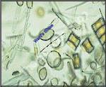 Diatoms Recent Marine (wm) Unstained frustule strew