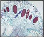 Marchantia Antheridia (ls) Shows antheridiophore chambers and general structures QS