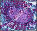 Lilium Ovary First 4 Nudeate Embryo Sac (cs) QS