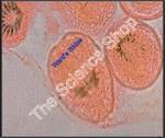 Echinococcus granulosus Hydatid Sand (wm) Fluid of hydatid cyst