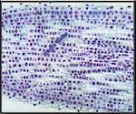 Onion Alium Root tip Mitosis (ls) Showinq all stages (ls) F