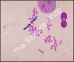 Normal Male 46 XY SM GS Spread arrested at metaphase showing normal complement