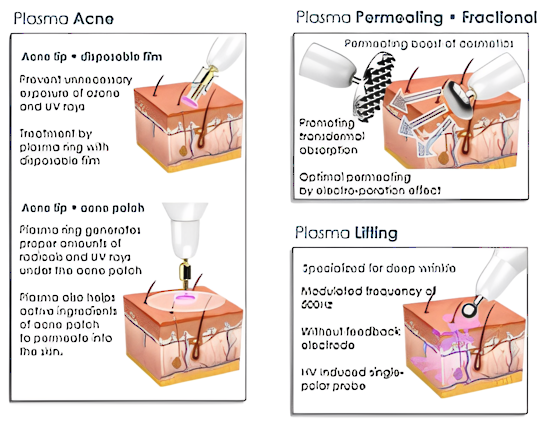 Plamere Fibroblast Plasma Treatment (Incl training plus starter kit) + BONUS $500 of Serums image 1