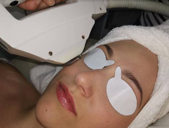 LASER LIGHT-SHIELD Disposable Eye Protection Shields  (24pr) image 0