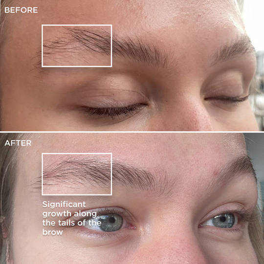 Brow Code Multi-Peptide Brow & Lash Growth Serum image 7